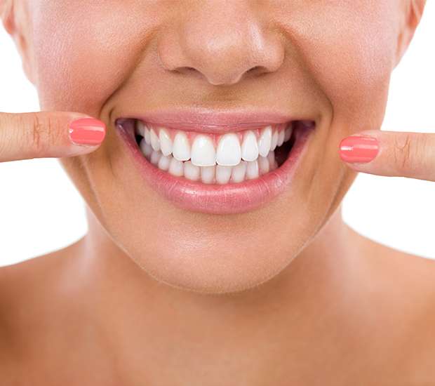 Los Angeles What Is Gum Contouring and Reshaping