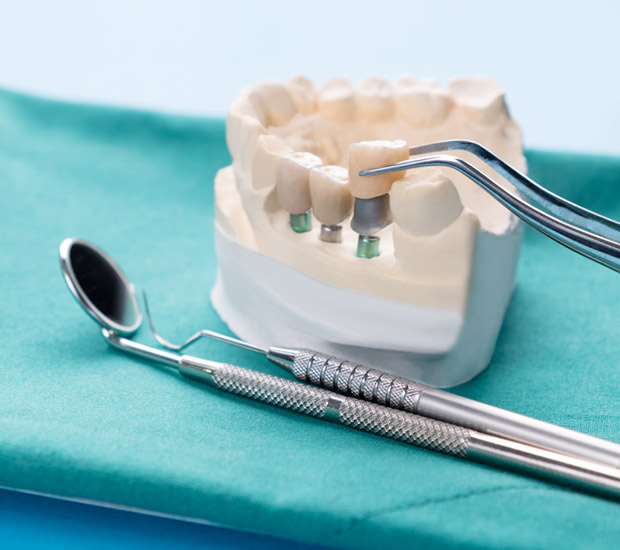 Los Angeles Prosthodontist