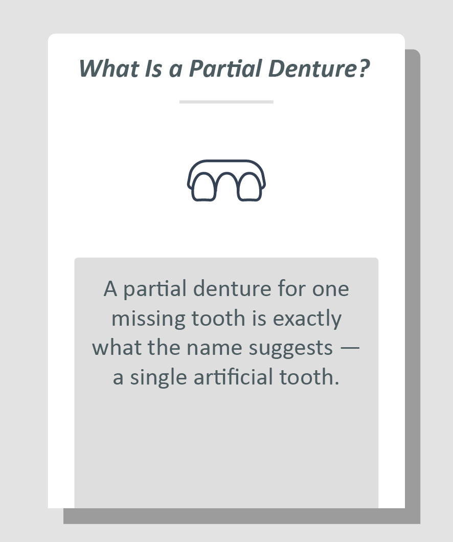 Partial denture for one missing tooth infographic: A partial denture for one missing tooth is exactly what the name suggests โ a single artificial tooth.